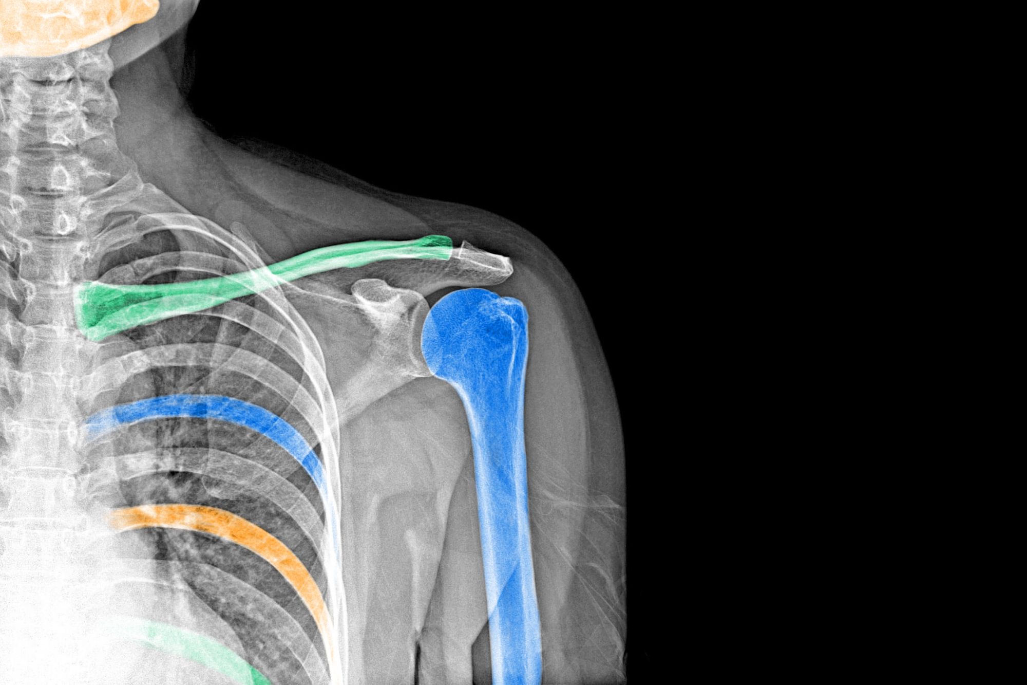 6 Amazing Facts About X Rays Interesting Facts